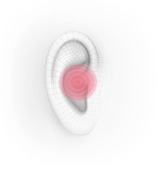 ear tinnitus